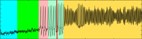 Figure3-TouboulMiniature.jpg Figure3-TouboulMiniature.jpg