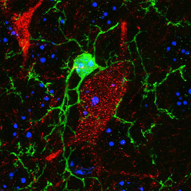 Colloque Interaction microglie et neurone (actu)