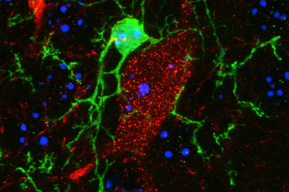 Interaction microglie et neurone