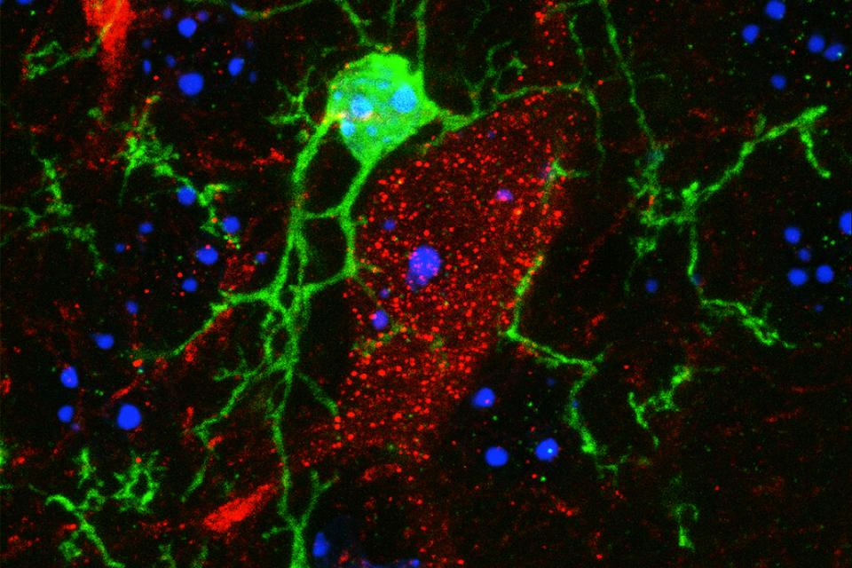 Interaction microglie et neurone Interaction microglie et neurone