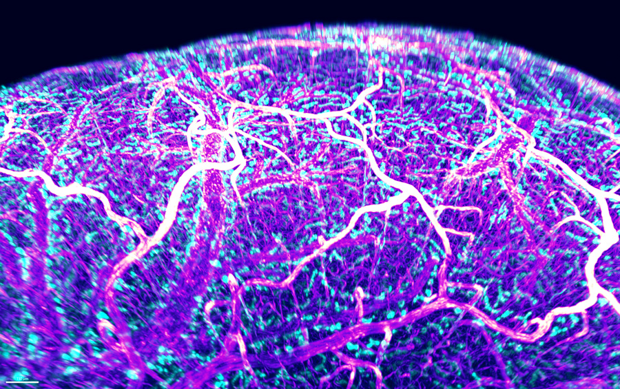 3D cleared entire brains, showing CNS-border associated macrophages (blue) lining the mouse brain vasculature (magenta).