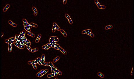 Localisation of a genes in the bacterial cell (Espeli)