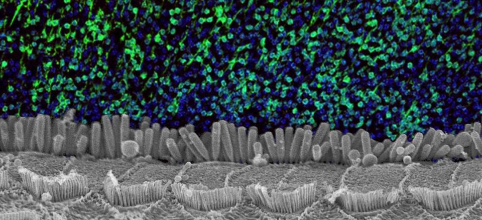 Montage photo avec, au premier plan, un champ de touffes ciliaires des cellules sensorielles de la cochlée et, en arrière-plan, des neurones du cortex auditif marqués en vert