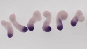 Expression du gène Cyp26a1 dans des gastruloides de souris