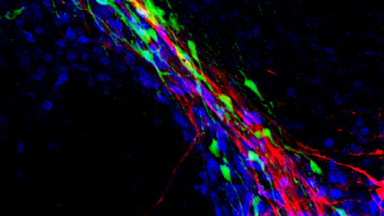 Image de microscopie montrant des structures cellulaires colorées (rouge, vert, bleu) formant un réseau lumineux sur fond noir