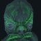 Innervation sensitive (en vert) du visage d’un embryon à 8 semaines de développement