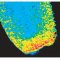 H2O2 sensing during wound healing