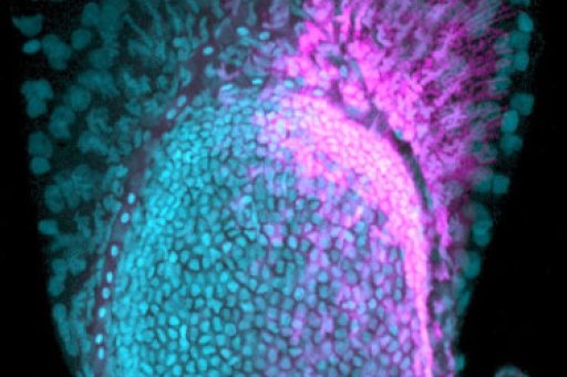 Expression d’un « gène des doigts » dans une nageoire de poisson