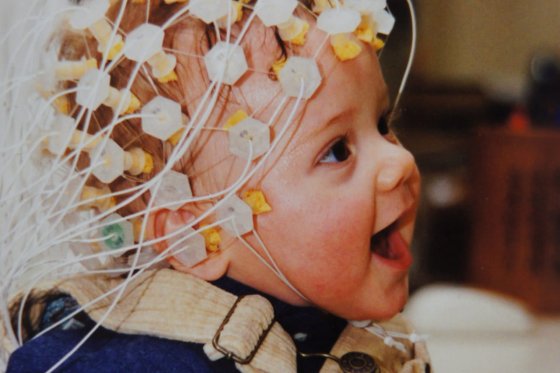 Enfant portant un casque d’électroencéphalographie (EEG) avec électrodes positionnées sur la tête.