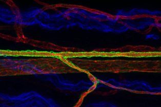 Vascularization of sciatic nerve: immunostaining showing endothelial cells in redd, axons in blue and mural cells in green