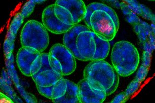 Evolution and development of brain cells Huynh