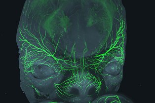 Innervation sensitive (en vert) du visage d’un embryon à 8 semaines de développement