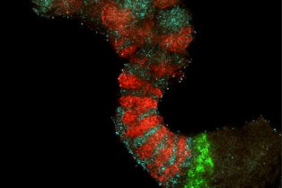 Coupe colorée de tissu biologique avec marquages Mesp2 (vert), Uncx (rouge) et Tbx18 (cyan)