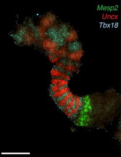 Coupe colorée de tissu biologique avec marquages Mesp2 (vert), Uncx (rouge) et Tbx18 (cyan)