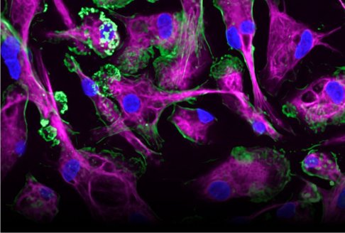 Purple-stained cells with blue nuclei and green structures, illustrating cellular activity observed by fluorescence microscopy.