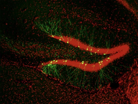 Vue au microscopique