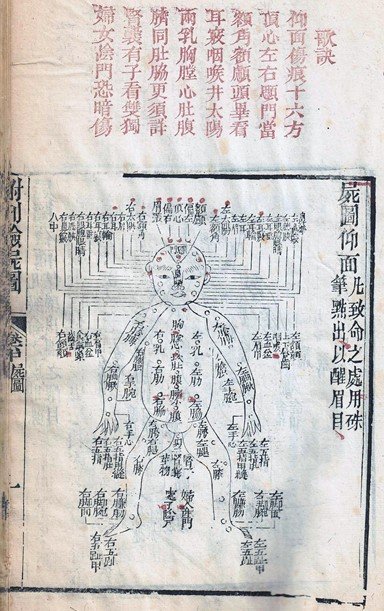 Schéma ancien d'acupuncture avec points et méridiens annotés en chinois