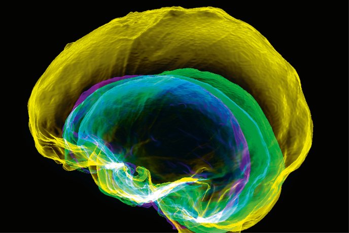 Brain endocasts of Australopithecus africanus (purple; over 3 million years old), Homo erectus (specimen KNM-ER 42700, green, approx. 1.55 million years old), Homo naledi (turquoise, approx. 300,000 years old), and a modern Homo sapiens (yellow).