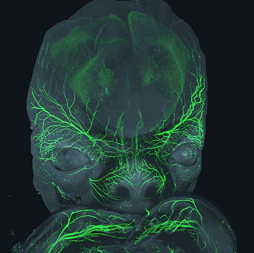 Innervation sensitive (en vert) du visage d’un embryon à 8 semaines de développement