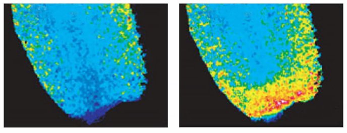 H2O2 sensing during wound healing