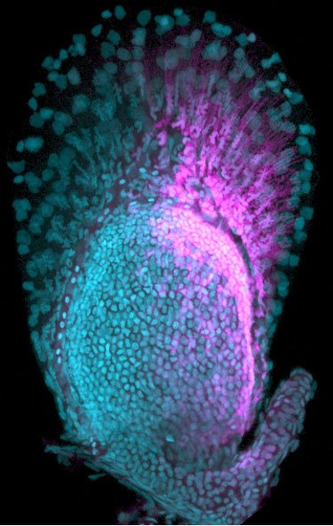 Expression d’un « gène des doigts » dans une nageoire de poisson