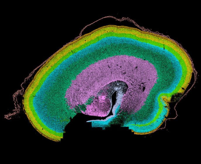 Afficher l'image en plein écran : Coupe sagittale d’un cerveau montrant ses différentes régions en fausses couleurs